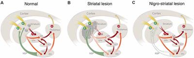 Neuronal Replacement as a Tool for Basal Ganglia Circuitry Repair: 40 Years in Perspective